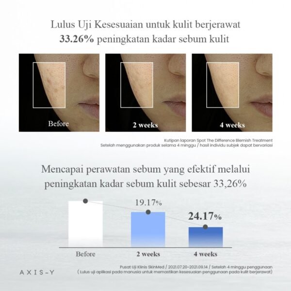 AXIS-Y Spot The Difference Blemish Treatment 15ml - Image 4