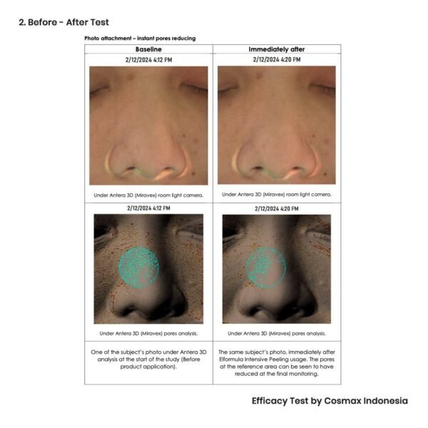 ELFORMULA Intensive Peeling Solution - Serum - Image 5