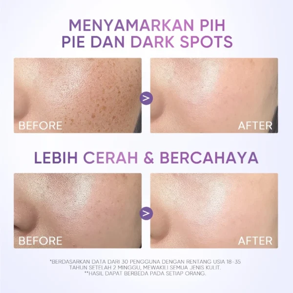 Skintific Symwhite 377 Dark Spot Moisturizer Gel Untuk Flek Hitam - Image 3