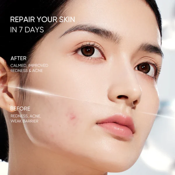 Skintific Sensitive Moisture Gel 40ml - Image 3